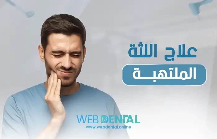 علاج اللثة الملتهبة image