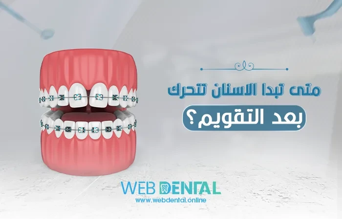 متى تبدا الاسنان تتحرك بعد التقويم image