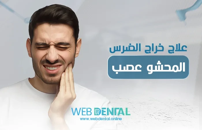 علاج خراج الضرس المحشو عصب image