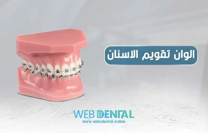 الوان تقويم الاسنان image