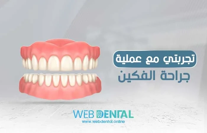 تجربتي مع عملية جراحة الفكين image