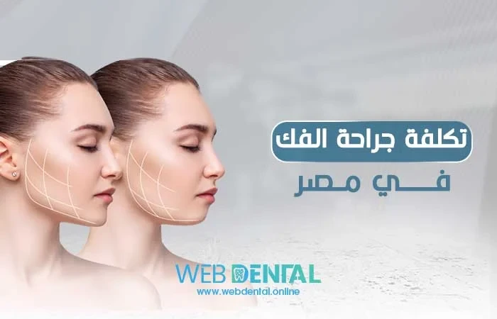 تكلفة جراحة الفك في مصر image