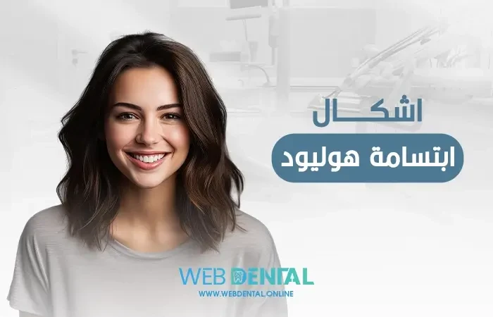 اشكال ابتسامة هوليود image