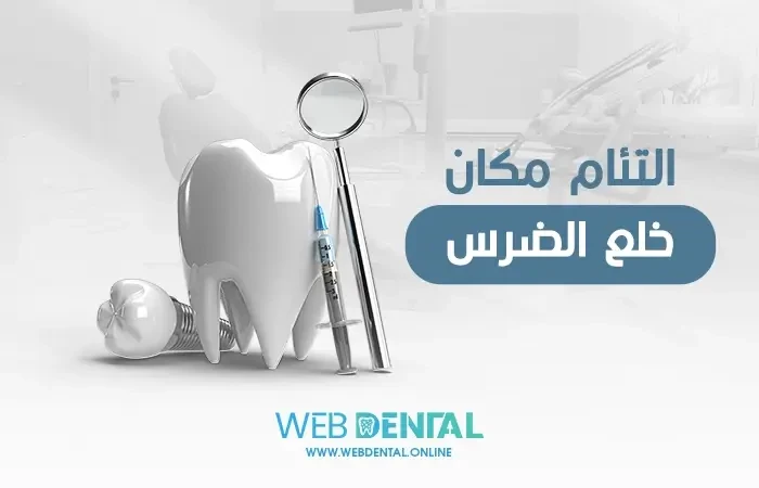 التئام مكان خلع الضرس image