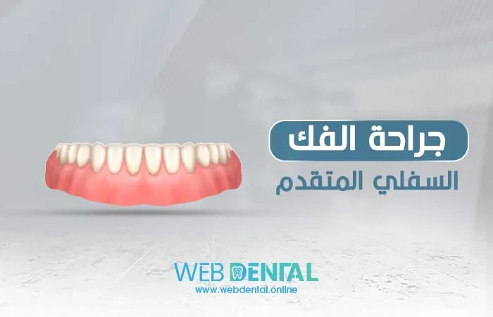 جراحة الفك السفلي المتقدم image