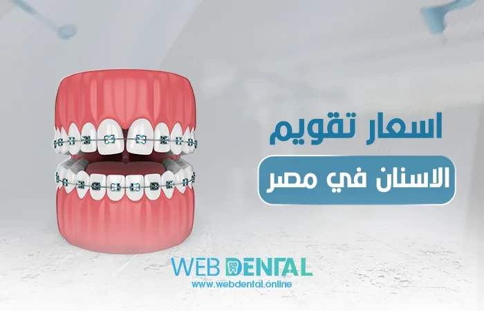 اسعار تقويم الاسنان في مصر image