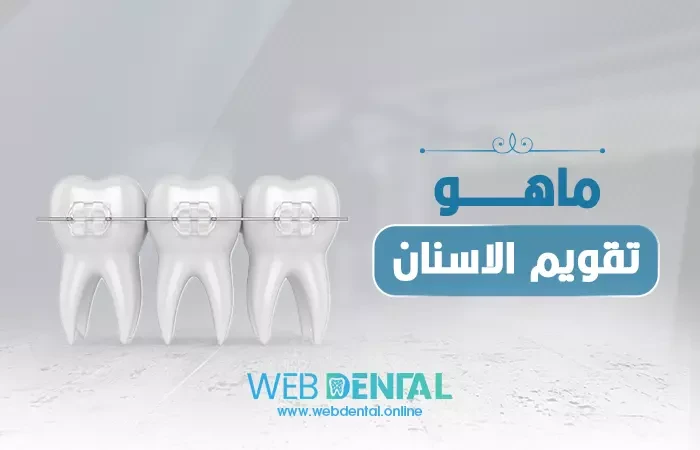 ماهو تقويم الاسنان image