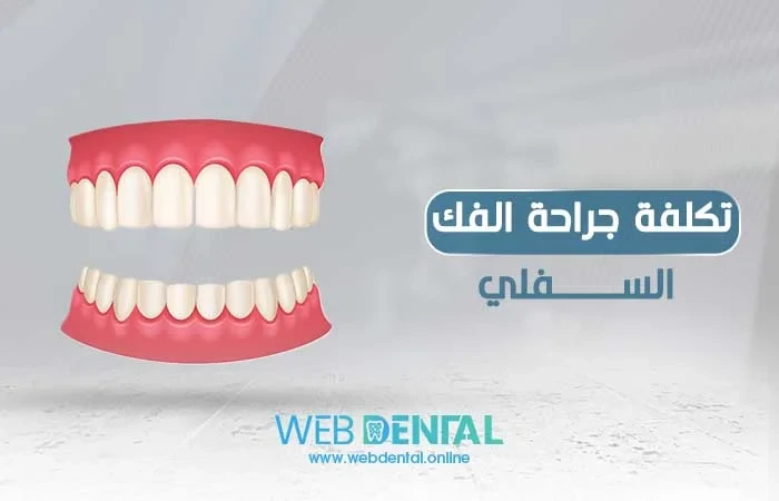 تكلفة جراحة الفك السفلي image