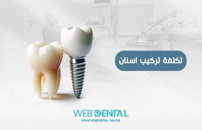 تكلفة تركيب ضرس image