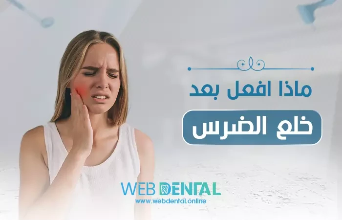 ماذا افعل بعد خلع الضرس image