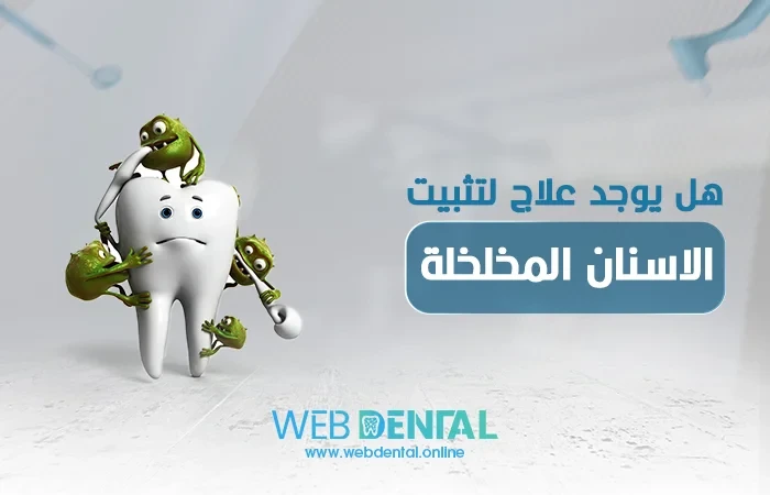 هل يوجد علاج لتثبيت الاسنان المخلخلة؟ image