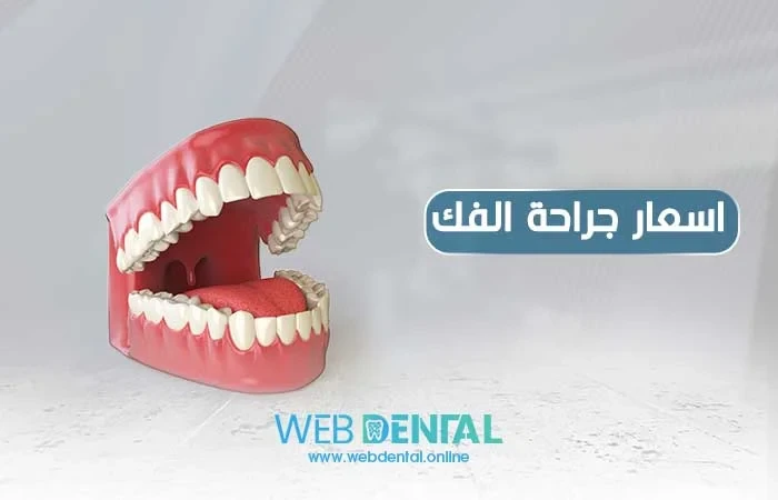 اسعار جراحة الفك image